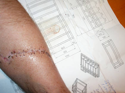 Der Arm sollte nicht eingebaut werden ... ;-)) Der Arm sollte nicht eingebaut werden ... ;-))